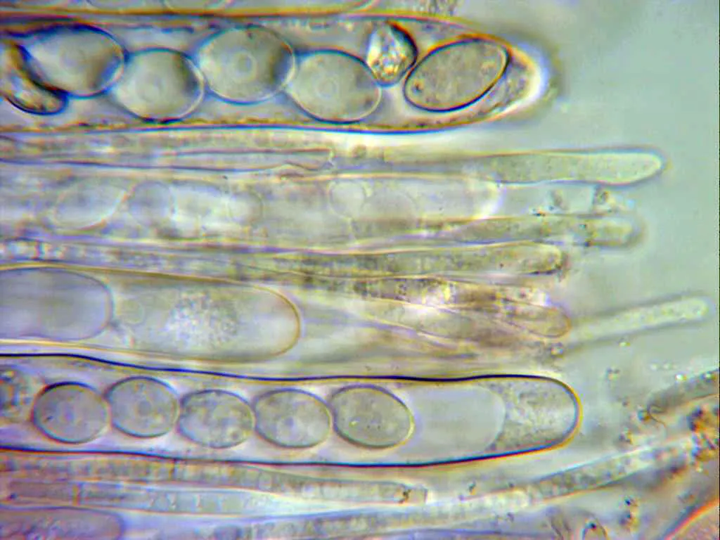Microscopía de Tricharina ochroleuca - 10 - Ascas y paráfisos 2